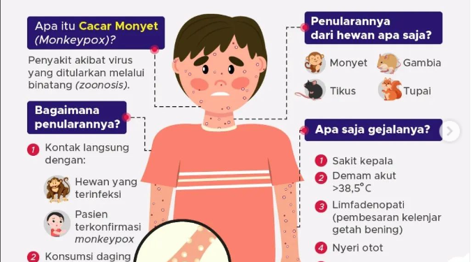 Pertama di Indonesia Satu Pasien Terkonfirmasi Menderita Cacar Monyet 1 Monkeypox