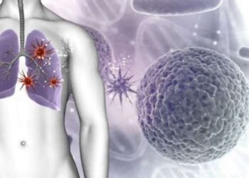 Tuberkulosis (TBC)
