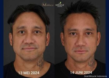 Miracle Luncurkan MIRACLE AI-Architectural Intelligence,Teknik Kunci Hasil Natural 1 miracle