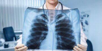 Pneumonia