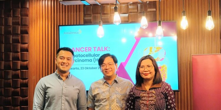 Bersama Lawan Kanker Hati Lewat Cancer Talk: Edukasi Publik tentang Deteksi Dini dan Terapi Inovatif