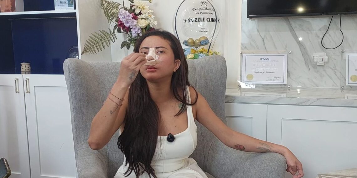 Blak-blakan Soal Operasi Plastik, Ayu Aulia: Biar Tetap Eksis dan Meng-update Diri