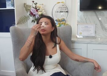 Blak-blakan Soal Operasi Plastik, Ayu Aulia: Biar Tetap Eksis dan Meng-update Diri