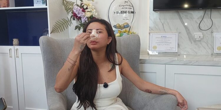 Blak-blakan Soal Operasi Plastik, Ayu Aulia: Biar Tetap Eksis dan Meng-update Diri