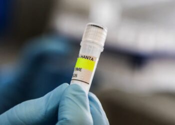 Menkes: Kasus Hantavirus di Jakarta Terkendali, Kontak Erat Dipantau 14 Hari