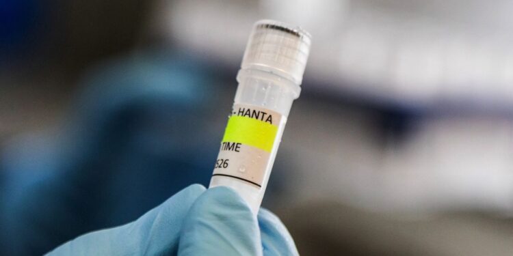 Menkes: Kasus Hantavirus di Jakarta Terkendali, Kontak Erat Dipantau 14 Hari