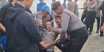 AKBP Adri Jalani Operasi Setelah Patah Tulang Lutut Saat Amankan Demo di DPR