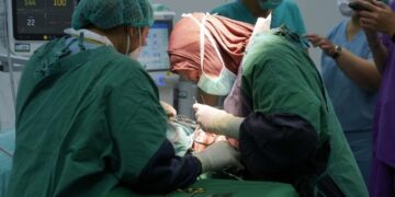 Bantu Anak Indonesia Tumbuh Sehat dan Percaya Diri, Operasi Kraniofasial Gratis Di Gelar