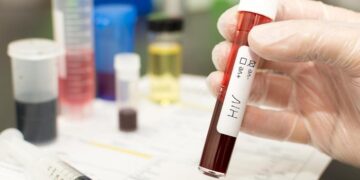 Dinkes Sidoarjo Klarifikasi Isu 522 Pelajar Terinfeksi HIV, Kasus Usia Sekolah Tercatat 60 Sejak 2001