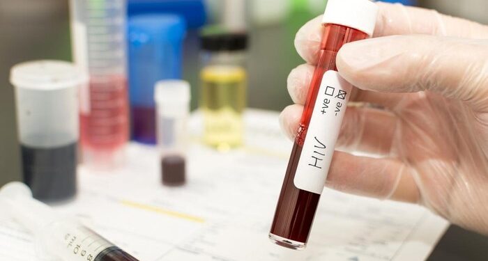 Dinkes Sidoarjo Klarifikasi Isu 522 Pelajar Terinfeksi HIV, Kasus Usia Sekolah Tercatat 60 Sejak 2001