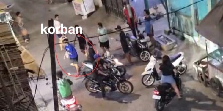 Tiga Pemuda di Cengkareng Dianiaya OTK, Satu Korban Dibacok hingga Lengan Hampir Putus 1 Tiga Pemuda di Cengkareng Dianiaya OTK, Satu Korban Dibacok hingga Lengan Hampir Putus